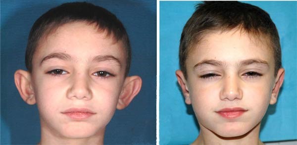 autoplasty 54879879879789