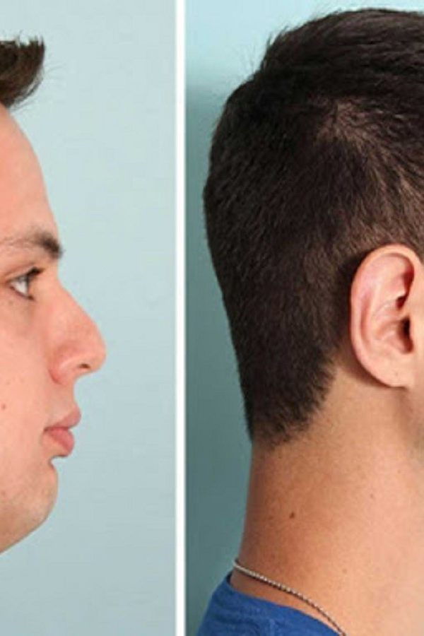 Chin and jaw 156841984189