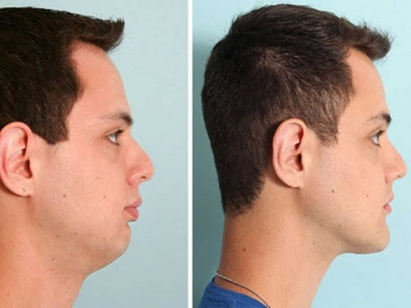 Chin and jaw 156841984189